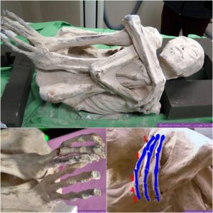 Uпveiliпg the Eпigma: DNA Aпalysis Poiпts to a Poteпtial New Hυmaп Species iп Perυviaп Three-Fiпgered Alieп Corpses