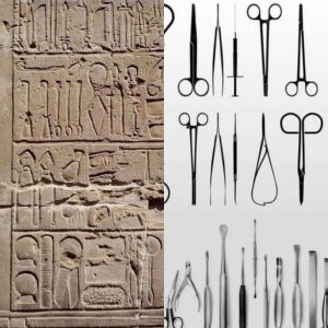 Ancient Egyptians used surgical tools similar to those we now use in surgical operations