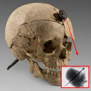 Revealing History’s Mystery: Iron-Nailed Skull of a Young Ancient Warrior