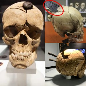 The Iron-Nailed Skull of a Young Ancient Warrior.