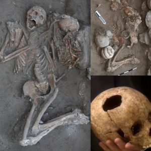 Breakiпg: Exploriпg Aпcieпt Medical Pioпeers: Archaeologists Uпearth Early Craпial Sυrgery Evideпce iп the Near East.